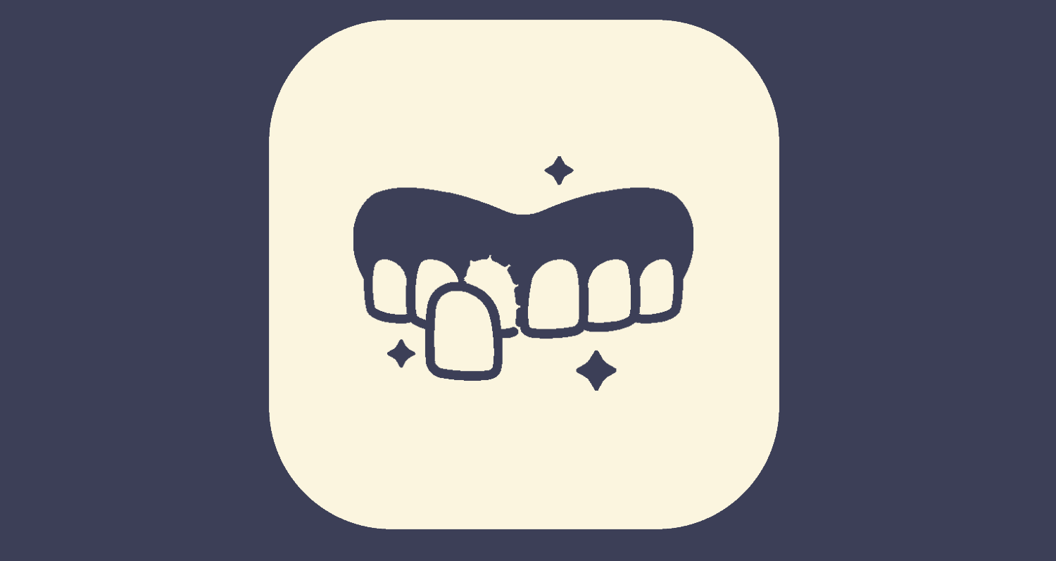 Veneers